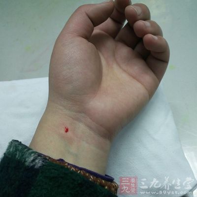 注射狂犬病疫苗应注意什么事项