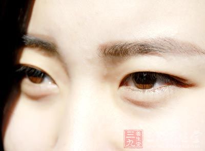 眼袋是现代女性的一代困扰 眼袋是现代女性的一代困扰