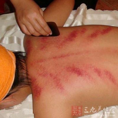 用刮痧板厚边棱角在人体肤表的一定部位 用刮痧板厚边棱角在人体肤表的一定部位