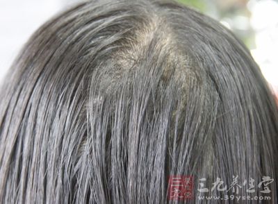 脾胃不好的人,应多梳前发际线 脾胃不好的人,应多梳前发际线