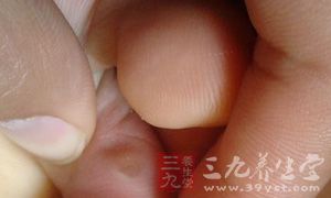 说到肾结石应该是无人不晓了