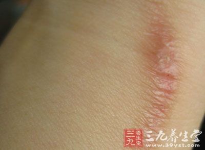 女人越长越丑全因身上有这物