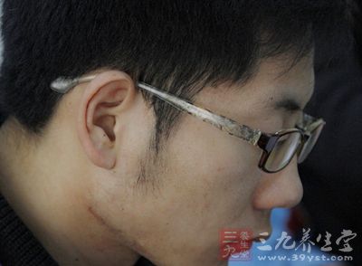 青光眼是一种典型的心身疾病