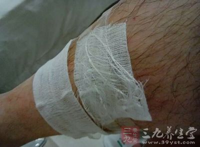 医生建议他接受手术治疗