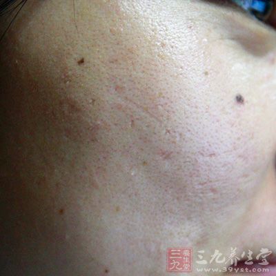 以及留在脸上的残留洁面乳或卸妆油,并清洁毛孔 以及留在脸上的残留洁面乳或卸妆油,并清洁毛孔