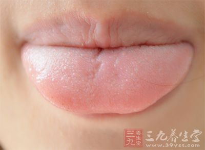 望舌诊病是中医长期实践积累的独特察病手段