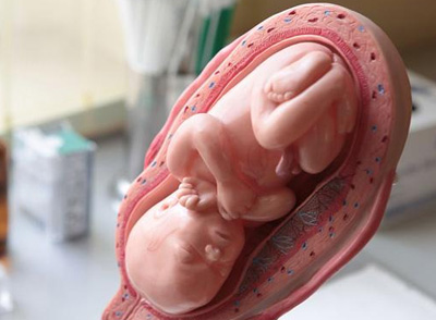 人们以为是胎儿在子宫里缺氧,或是怀疑胎儿有心脏病而感到了胎心跳动