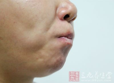 突然说话不利索或流口水 突然说话不利索或流口水