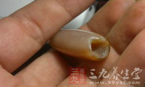 导致女性不孕的其他因素 导致女性不孕的其他因素