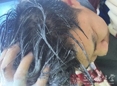 脱发原因 男人脱发大多是头洗的不对