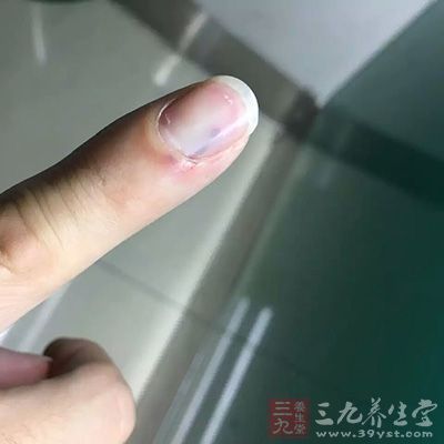 难免由于各种原因外伤导致皮肤出现伤口 难免由于各种原因外伤导致皮肤出现伤口