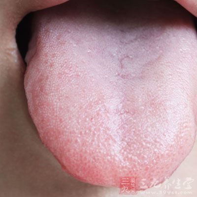 舌面上的裂紋有深裂、淺裂以及各個不同方向的裂溝和皺紋