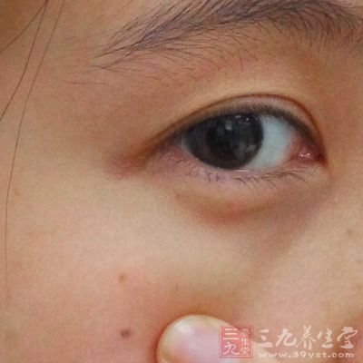 还有就是黄疸的可能，因为临床上黄疸的症状就是白眼球发黄