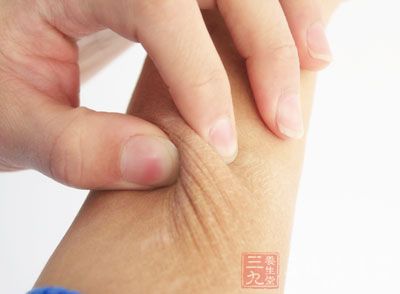 十分难受，甚至会有皮肤、粘膜恶变的可能