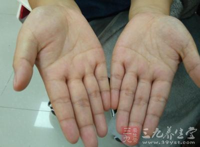 双手分别将拇指、中指、无名指捏在一起 双手分别将拇指、中指、无名指捏在一起