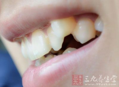 龋齿怎么办 治疗龋齿的方法有哪些