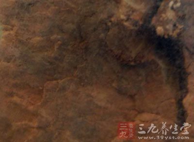 治疗肠风下血的偏方-三九养生堂养生百科