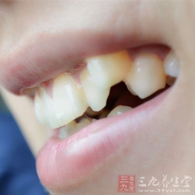 牙發(fā)育和形成過程中出現(xiàn)形態(tài)、結(jié)構(gòu)的異常