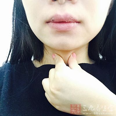 感冒后小心甲状腺发炎