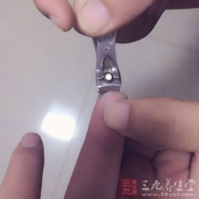 勤剪脚趾甲，剪成弧形，甲沟两侧不留趾甲尖，不随便剪甲沟