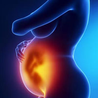 妊娠腹痛的辨证论治