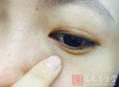 內(nèi)眼角上方一點(diǎn)，摸到一個(gè)小坑就是