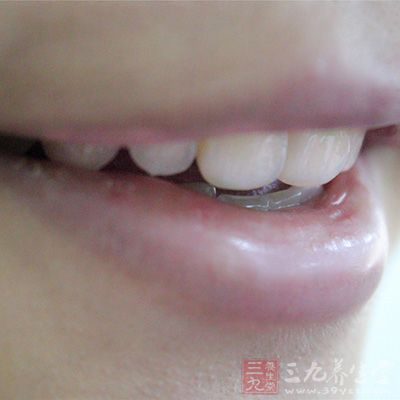 月经期不宜做的事三、不适宜拨牙 月经期不宜做的事三、不适宜拨牙