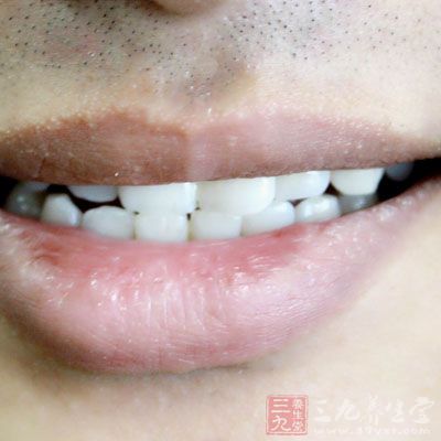 男性30岁以后牙齿容易变脏