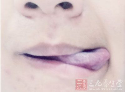 但还是有一些漏网之鱼会残留在口腔当中 但还是有一些漏网之鱼会残留在口腔当中