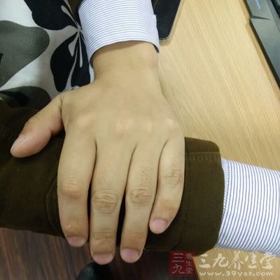 肢体瘫痪、癫痫及智力减退等后遗症