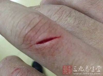 专门帮人换药 专门帮人换药