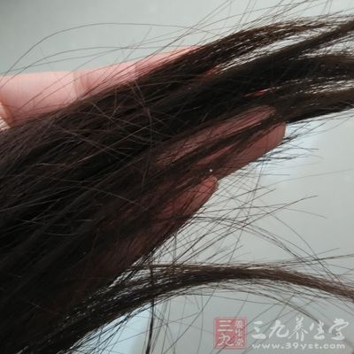 洗头时,头发大量脱落 洗头时,头发大量脱落
