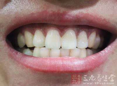 慢性进展性的牙齿松动多由于牙周炎引起 慢性进展性的牙齿松动多由于牙周炎引起