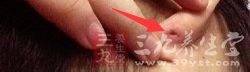 不适当地打耳洞，也会给健康带来危害