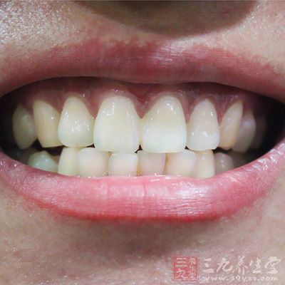 如牙位正、能正常萌出,并有对颌牙行使咀嚼功能者 如牙位正、能正常萌出,并有对颌牙行使咀嚼功能者