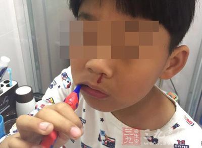江苏一小学多名学生流鼻血 附近化工厂停产