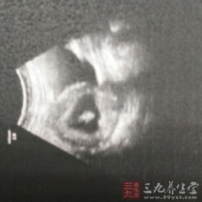 抽血及肝、膽B(tài)超須空腹進行