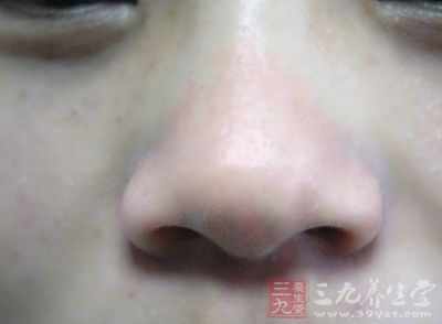 从而引起鼻腔后段外侧静脉丛血管破裂 从而引起鼻腔后段外侧静脉丛血管破裂