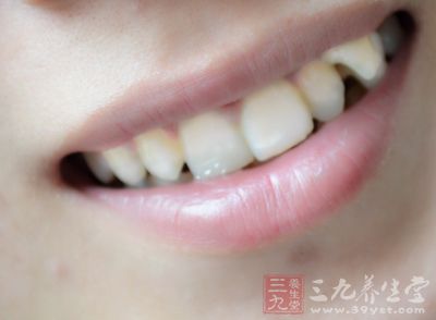 洗牙重在清洁，不等于美白牙齿