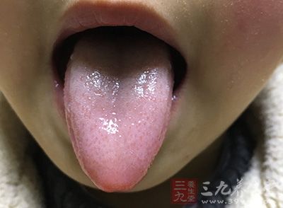 普通人的舌长4—7厘米