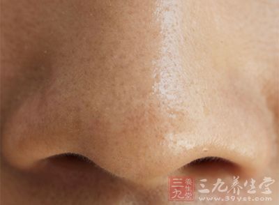 鼻出血(epistaxis)又稱鼻衄