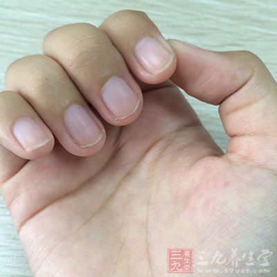 手足湿疹通常瘙痒感剧烈 手足湿疹通常瘙痒感剧烈