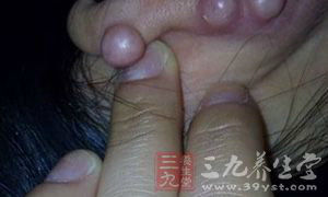 男人这里酸硬 小心健康隐患 男人这里酸硬 小心健康隐患