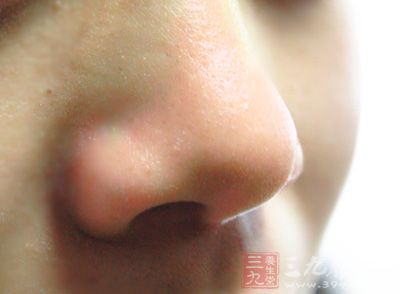 鼻窦炎怎么治疗 治疗鼻窦炎的方法有哪些