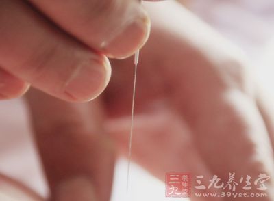 针灸减肥缓解工作压力还可补肾 针灸减肥缓解工作压力还可补肾