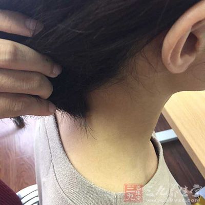 甲状腺可提高机体代谢率