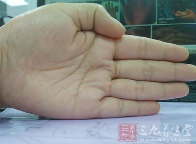 感情线在中国古典相学里叫“天纹” 感情线在中国古典相学里叫“天纹”