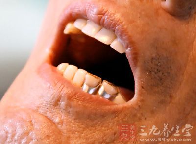 口腔疾病 你了解如何正确预防口腔疾病吗