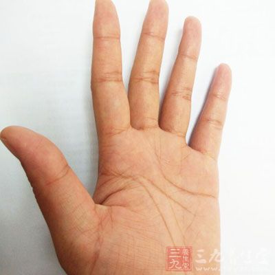 中医常识 观察手部变化竟能辨别身体情况(2)
