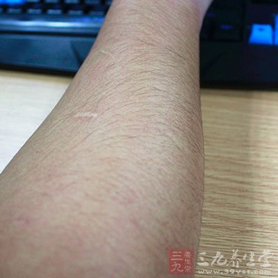 所以,脱毛的佳时机是排卵期 所以,脱毛的佳时机是排卵期